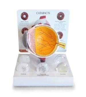 Cataract Eye Model